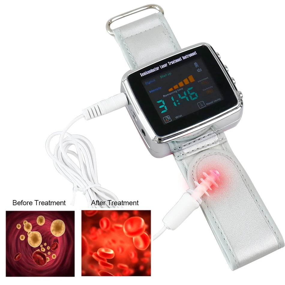 650nm Laser Therapy Wrist Watch LLLT for Circulatory Health