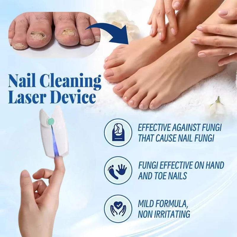 Лазер за нокти за лечение на онихомикоза с доказан ефект
