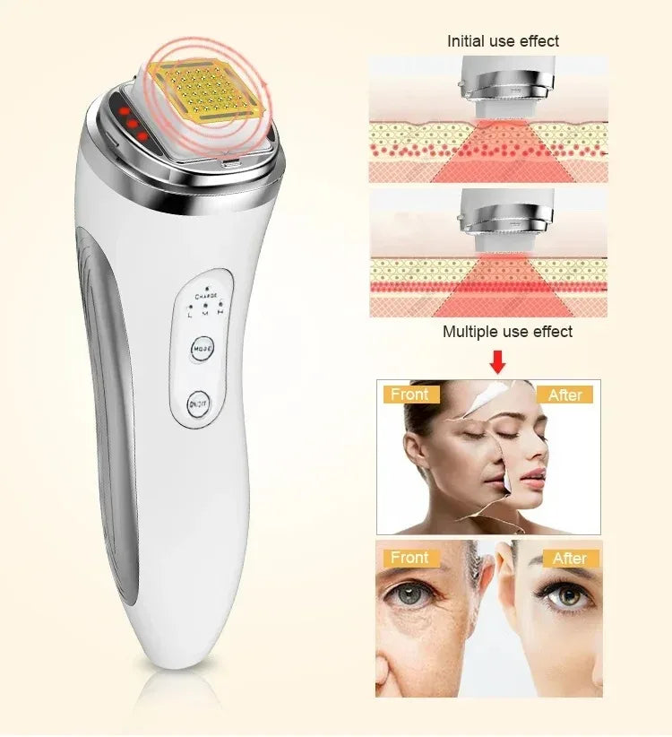 Electric Facial Lifting Machine &ndash; Anti Wrinkle And Lifting
