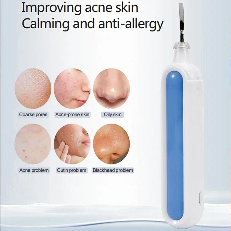 Portable Pore Cleansing Skin Scrubber &ndash; Ultrasonic Cleaning