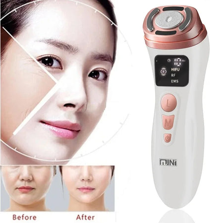 New Mini HIFU Ultrasonic Facial Machine &ndash; Firming Lift