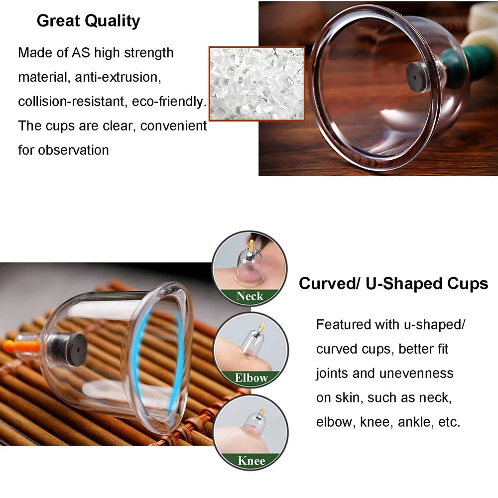 Cupping Therapy Set &ndash; Effective Cellulite Relief and Back Pain Therapy