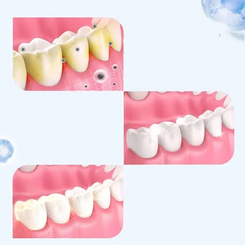 2-14 Pairs Gel Tooth Whitening Kit &ndash; Natural Brightening Strips