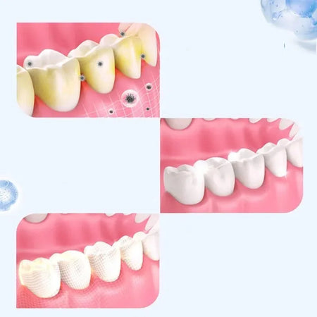 2-14 Pairs Gel Tooth Whitening Kit &ndash; Natural Brightening Strips