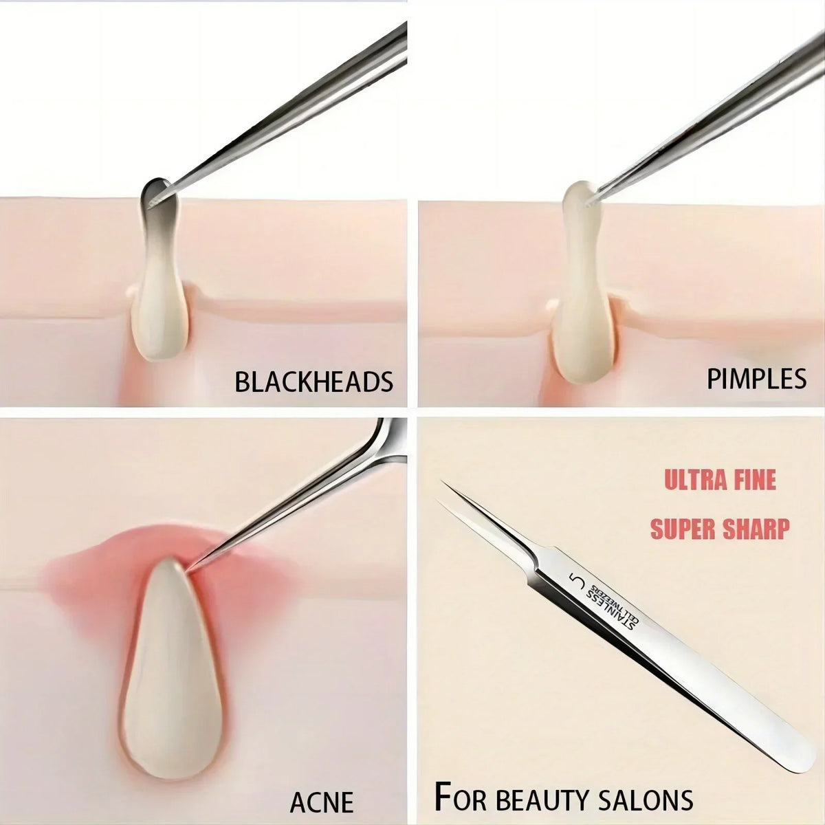 Extra Fine No. 5 Blackhead Tweezers - Precision Acne Removal Tool