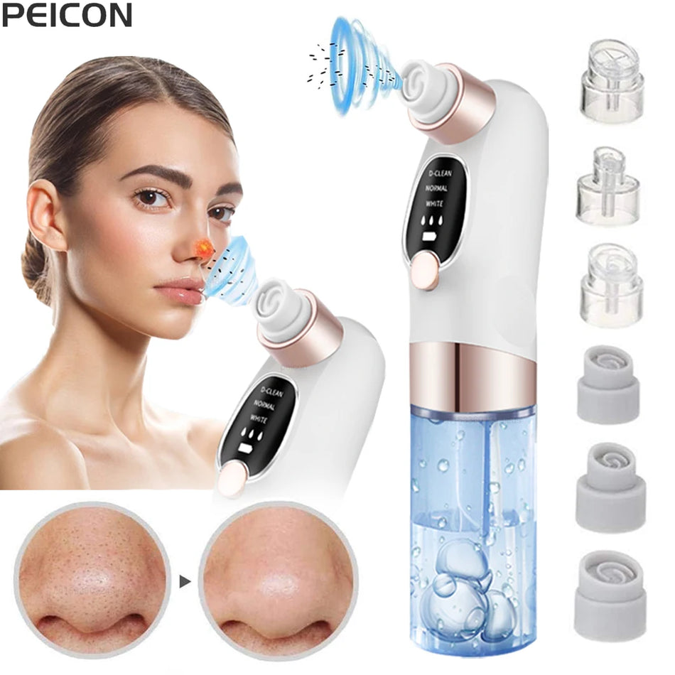 Zwarte Punt Verwijderaar Pore Vacuum Voor Gezicht, Acne Vlek Extractor