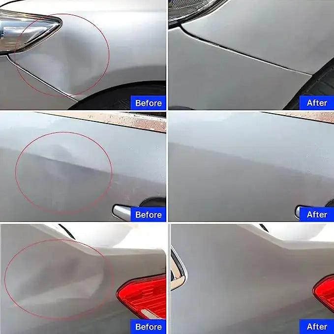 Car Paintless Dent Repair Kit Multiple Suction Sizes