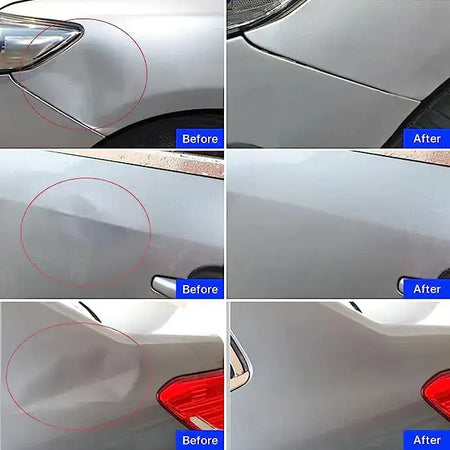 Car Paintless Dent Repair Kit Multiple Suction Sizes