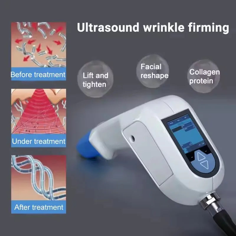 Epilador Ultra 360 para quemar grasa, levantar el rostro, tensar la piel y contornear el cuerpo