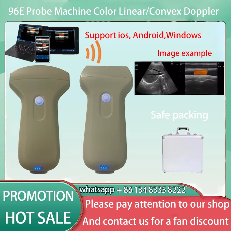 Przenośna bezprzewodowa sonda ultradźwiękowa 96E Doppler Sonostar