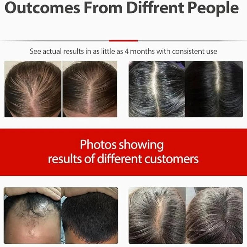 Nastavitelná červená světelná terapie čepice 100 LED pro růst vlasů