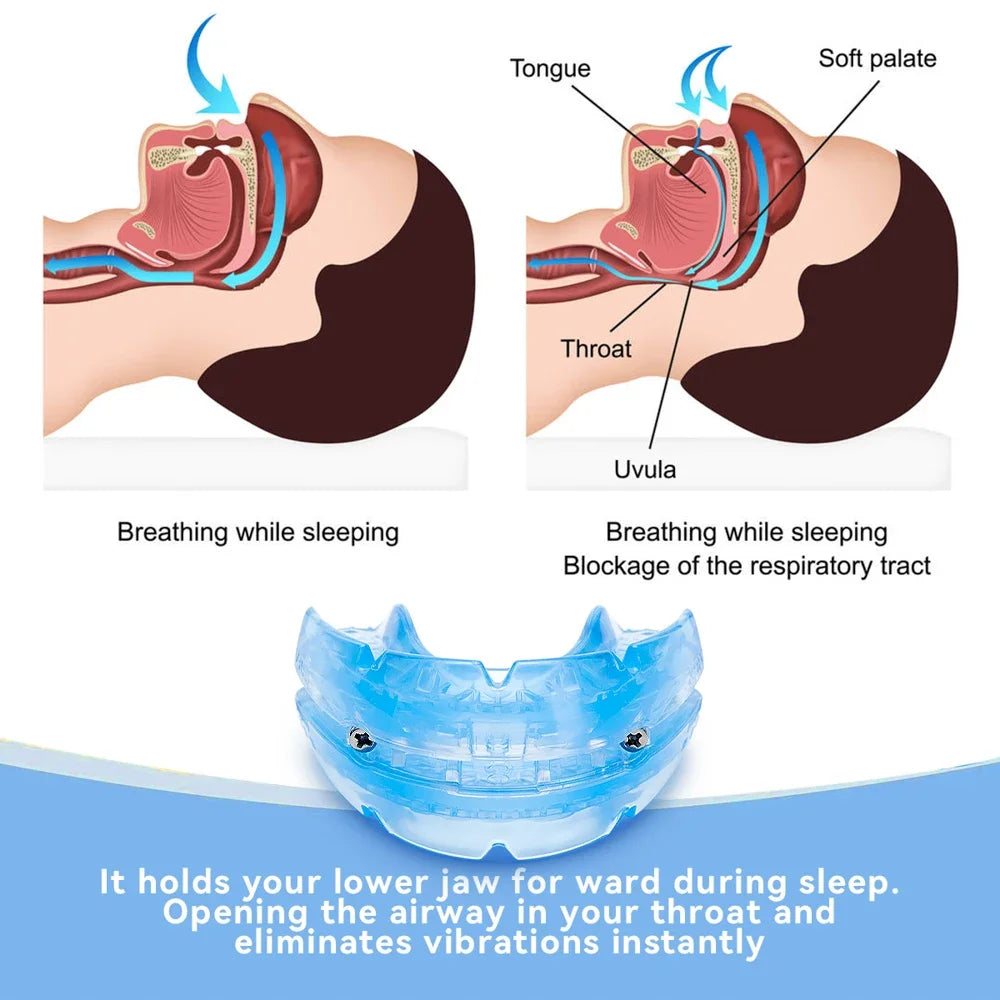 Anti Snoring Bruxism Mouth Guard - Adjustable Sleep Aid