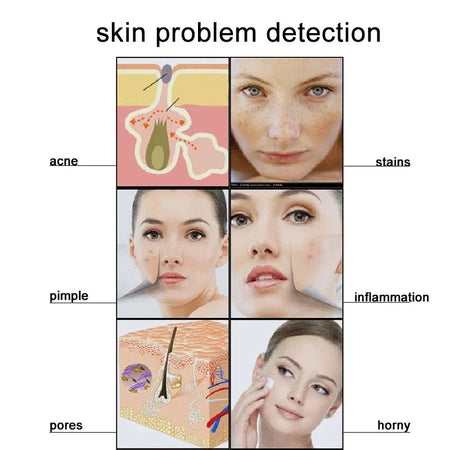 5 Inch Skin Analyzer &ndash; Skin Hair Scalp Detector Pro Edition