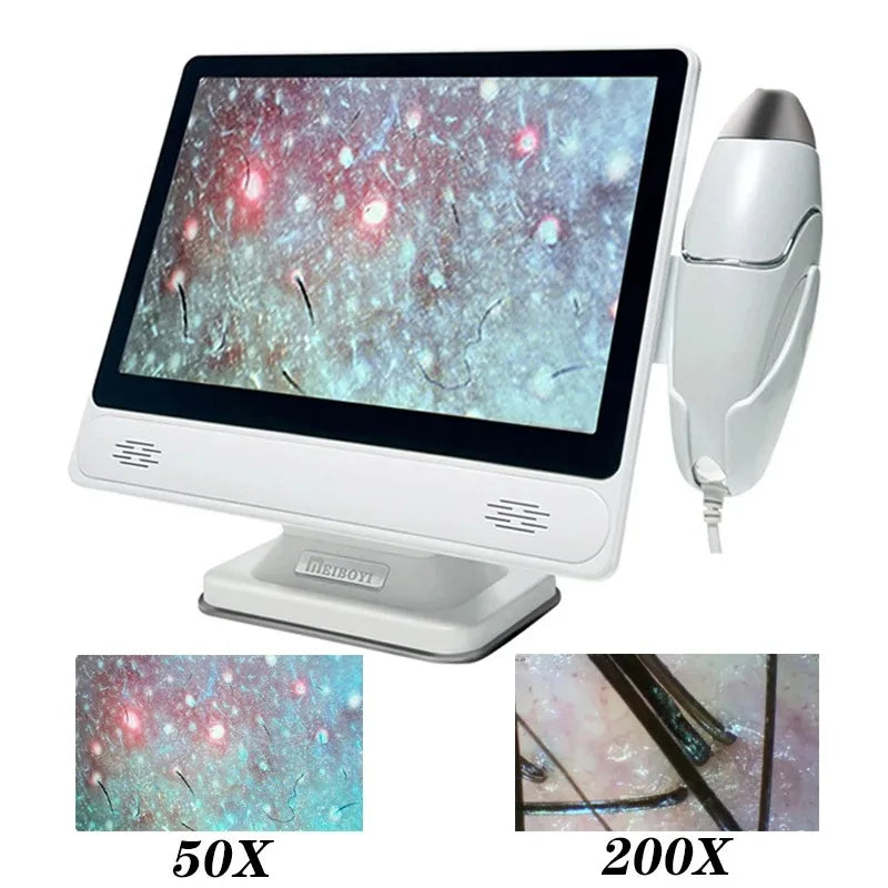 HD Digital Skin Analyzer Pro &ndash; Hair Follicle Detector
