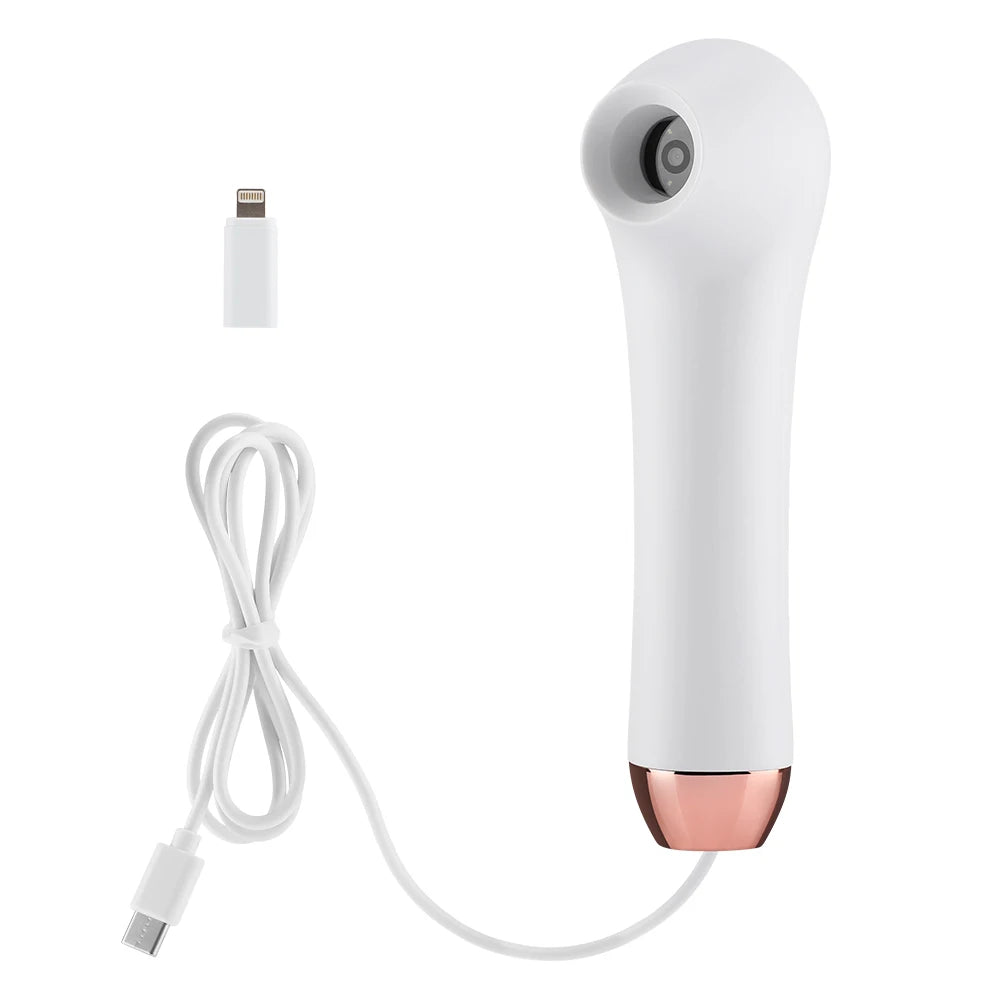 Skin Analyzer Dermatoscope &ndash; Ultra Clear Imaging Tech WHITE