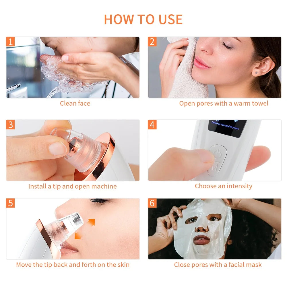 ForeverLily Blackhead Remover &ndash; Effective Facial Cleansing