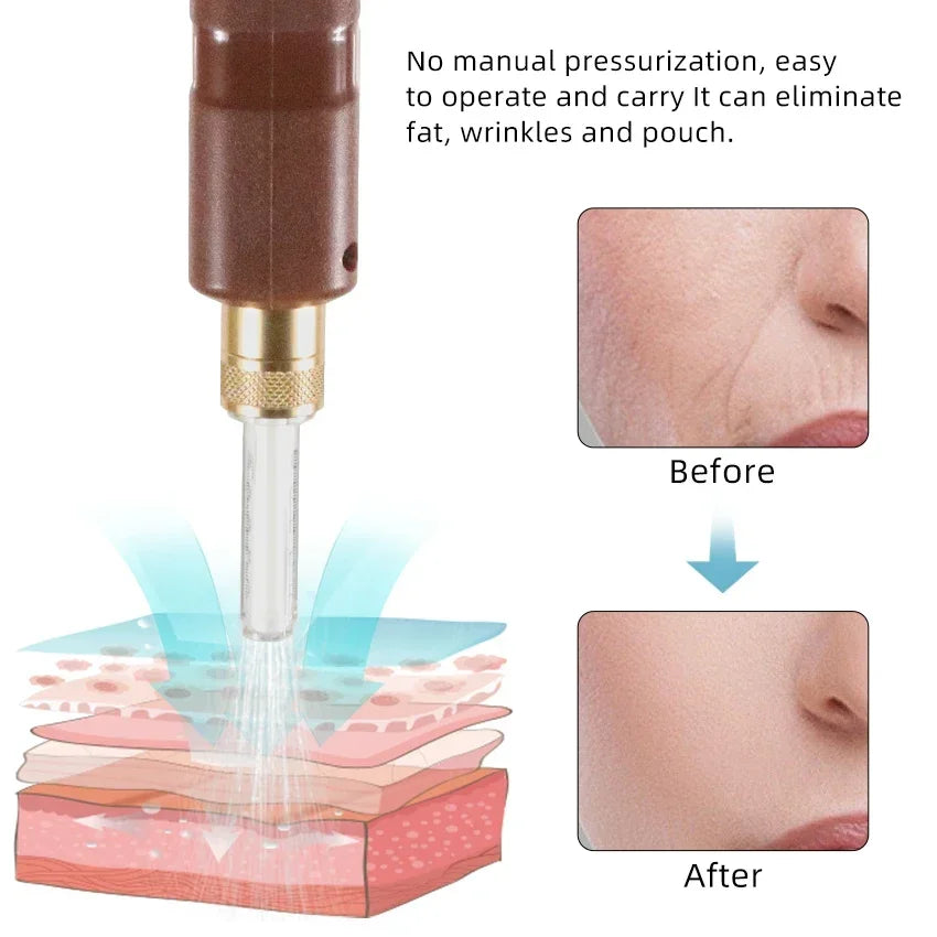 2 in 1 Electric Hyaluron Pen &ndash; High Pressure Delivery