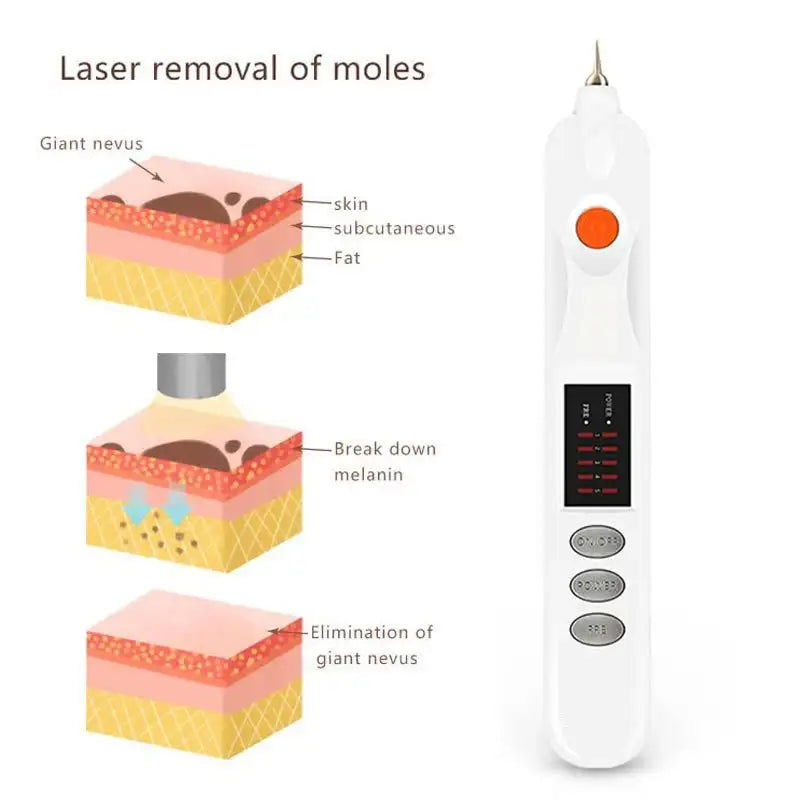 Ionic Spot Pen For Freckles And Mole Removal Skin Care