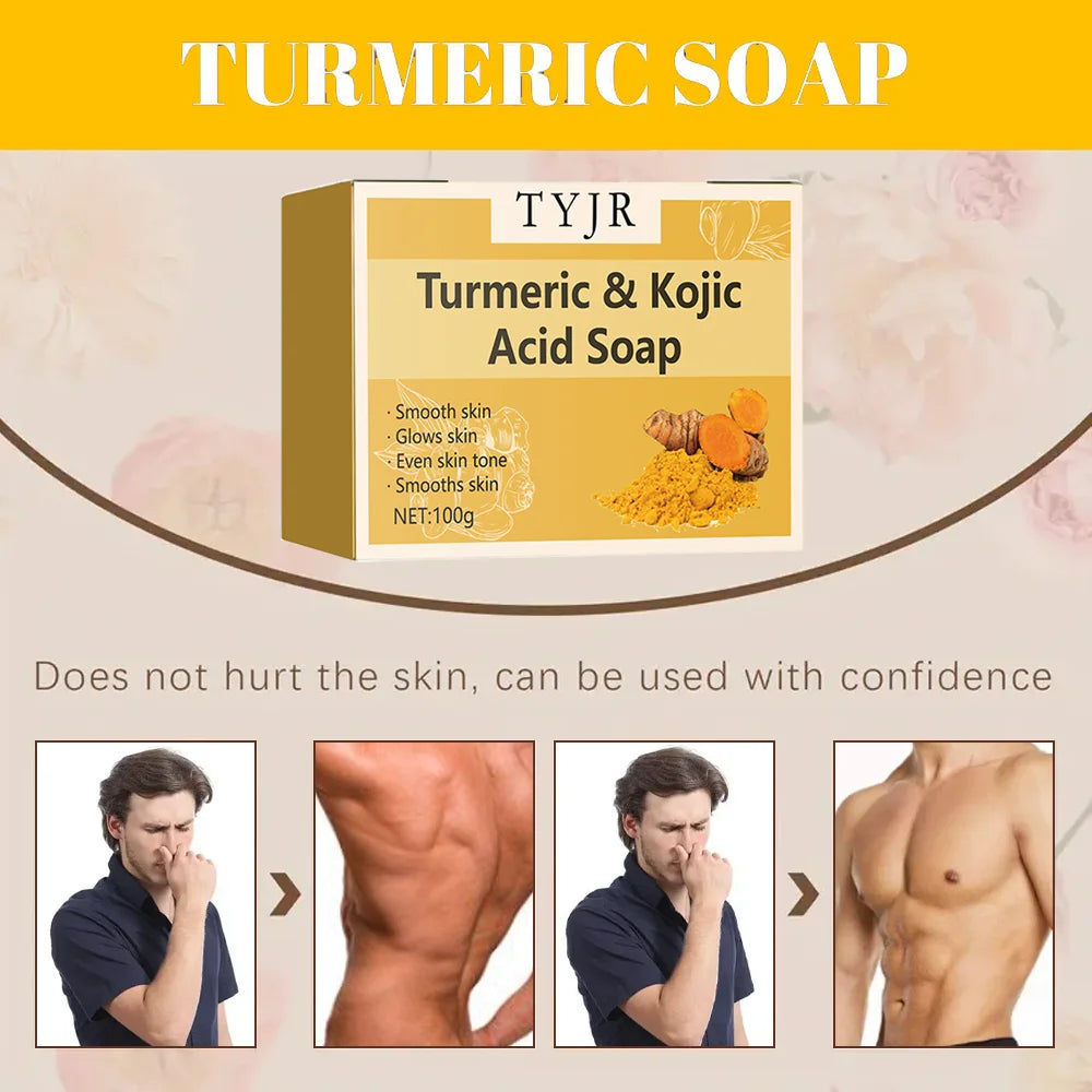 Ginger Turmeric Soap &ndash; Acne-Fighting and Skin Brightening