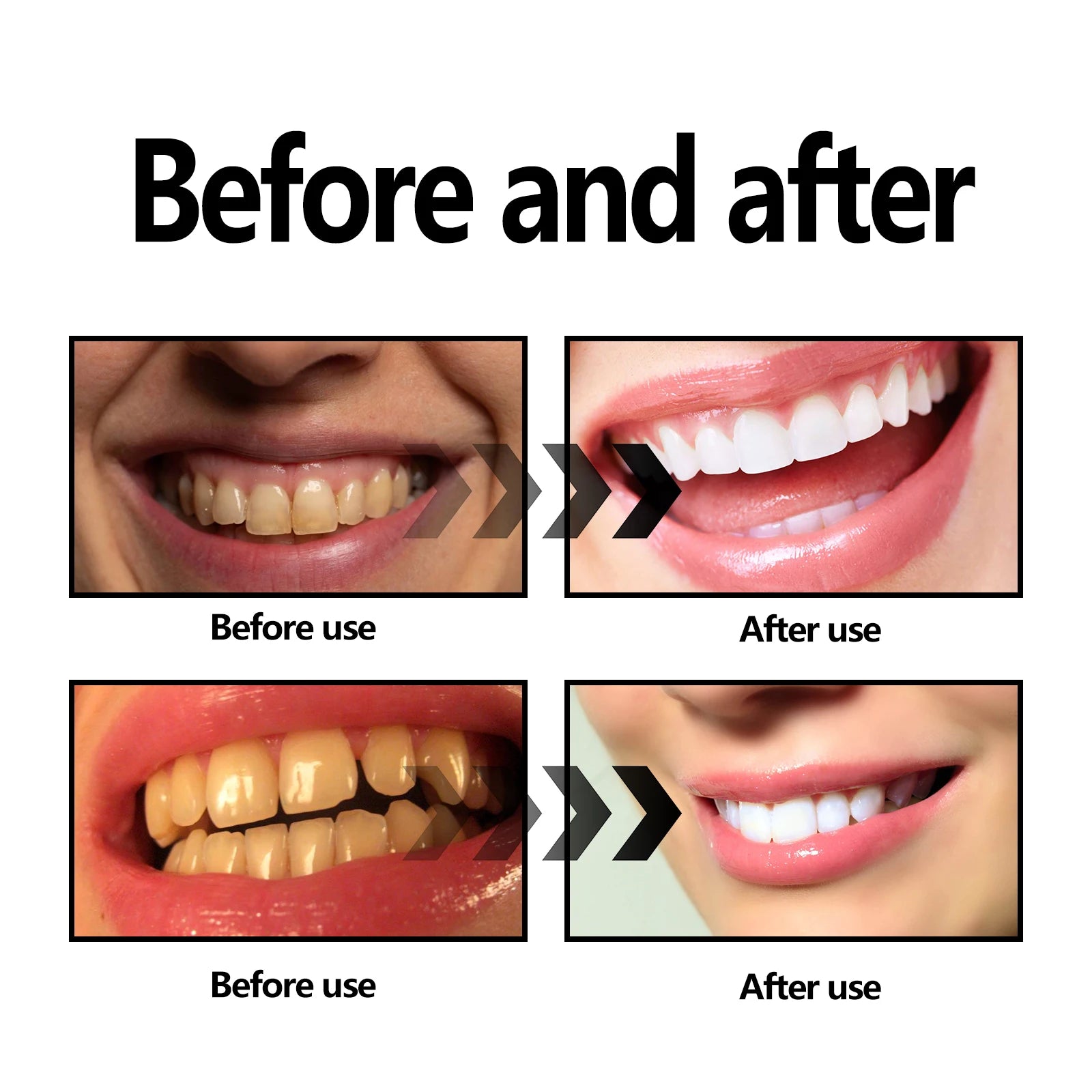 eelhoe Activated Coconut Charcoal Tooth Powder &ndash; Deep Cleaning Oral Hygiene