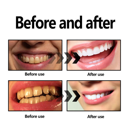 eelhoe Activated Coconut Charcoal Tooth Powder &ndash; Deep Cleaning Oral Hygiene