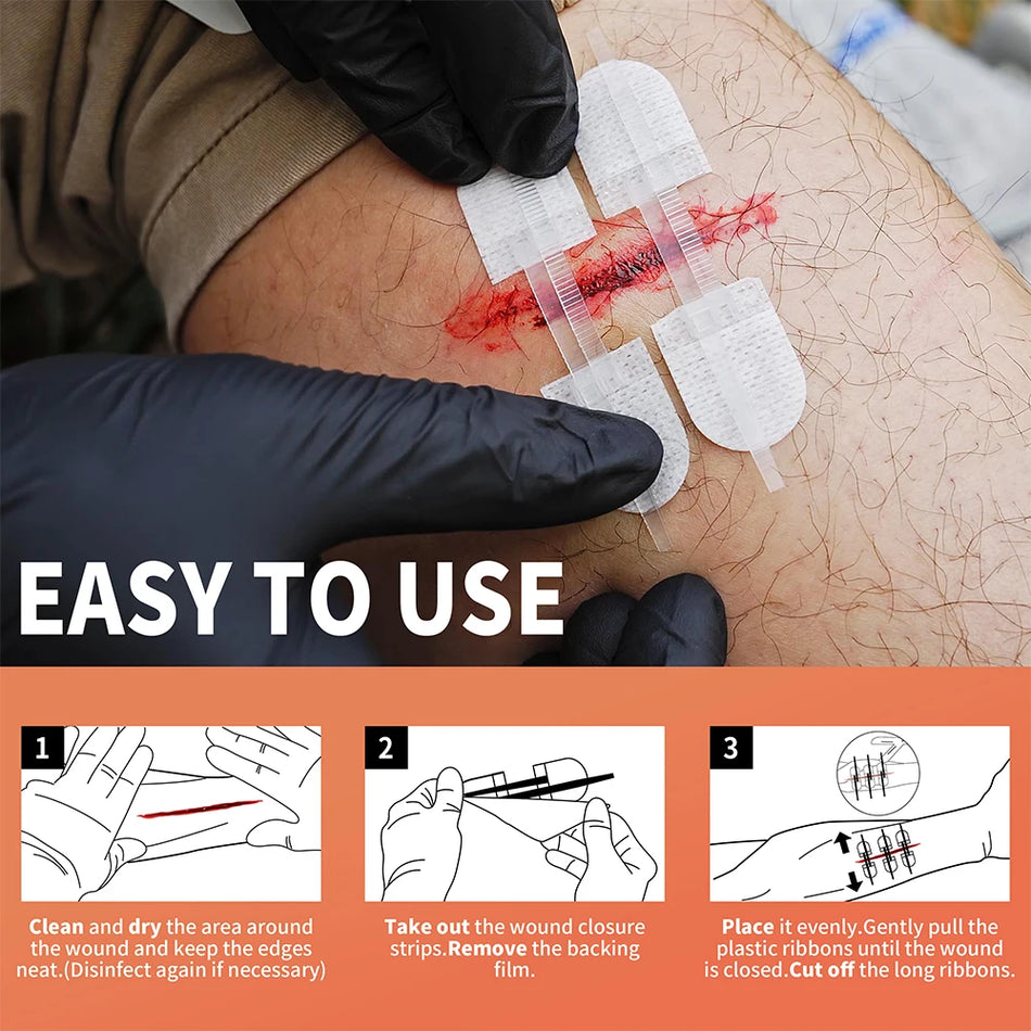 Strisce di Chiusura per Ferite Zip Stitch Rhino Rescue Pronto Soccorso