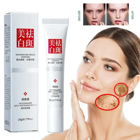Freckle Dark Spot Face Cream with Niacinamide &amp; Vitamin E Default Title