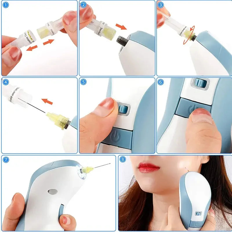 Needle Fibroblast Maglev Plasma Pen 50Pcs &ndash; Wrinkle Lift