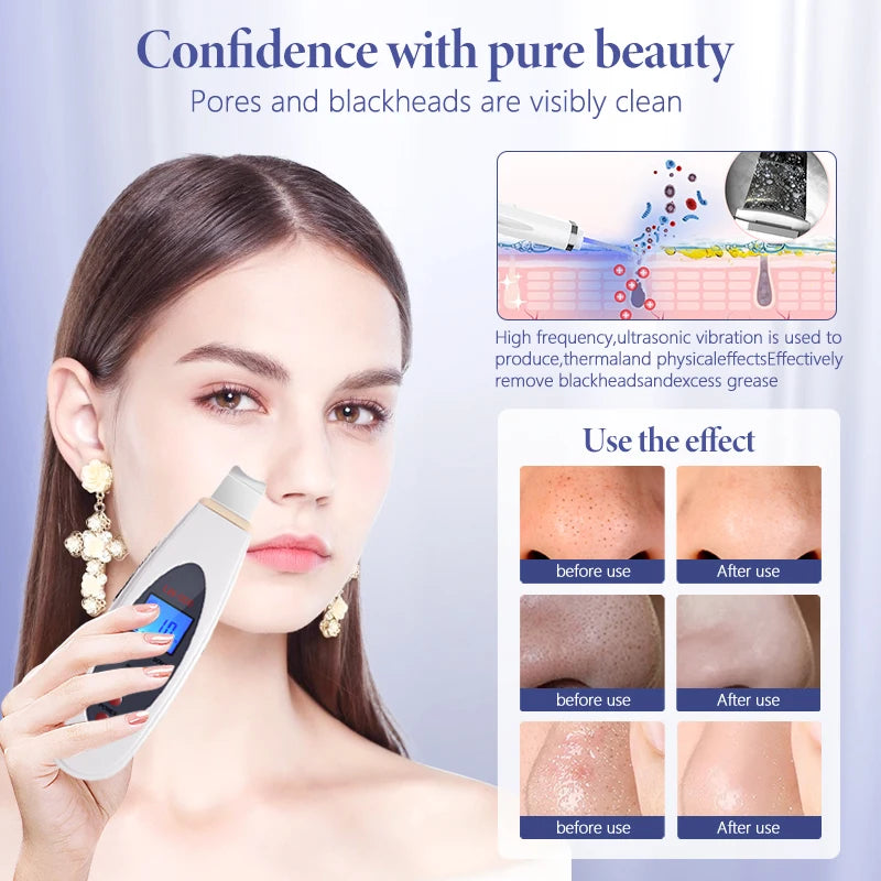 Ultrasonic Skin Scrubber Facial Cleanser Pore Cleansing