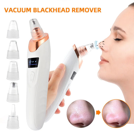 ForeverLily Blackhead Remover &ndash; Effective Facial Cleansing