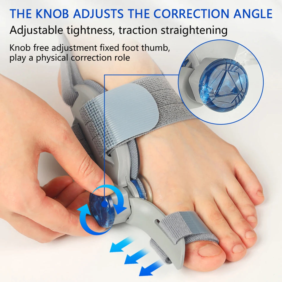 Thumb Valgus Corrector &ndash; Adjustable Knob For Custom Fit