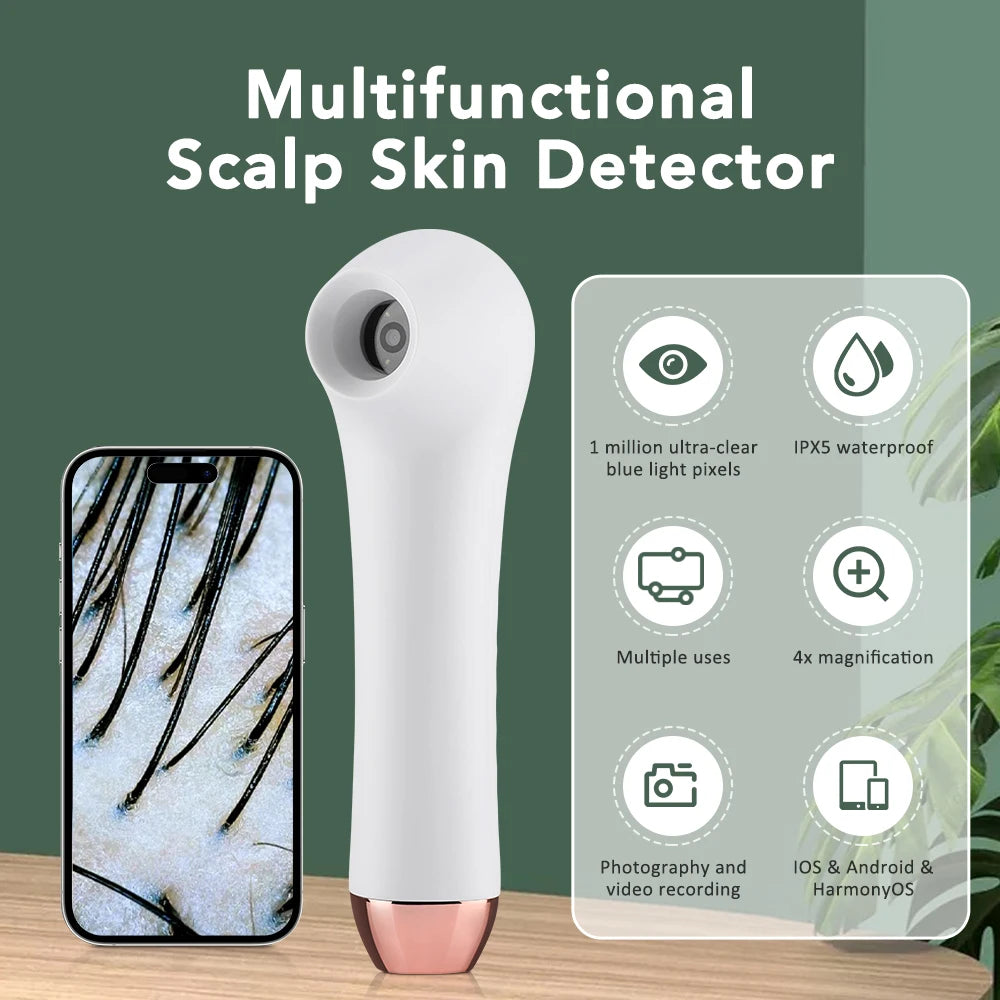 Skin Analyzer Dermatoscope &ndash; Ultra Clear Imaging Tech