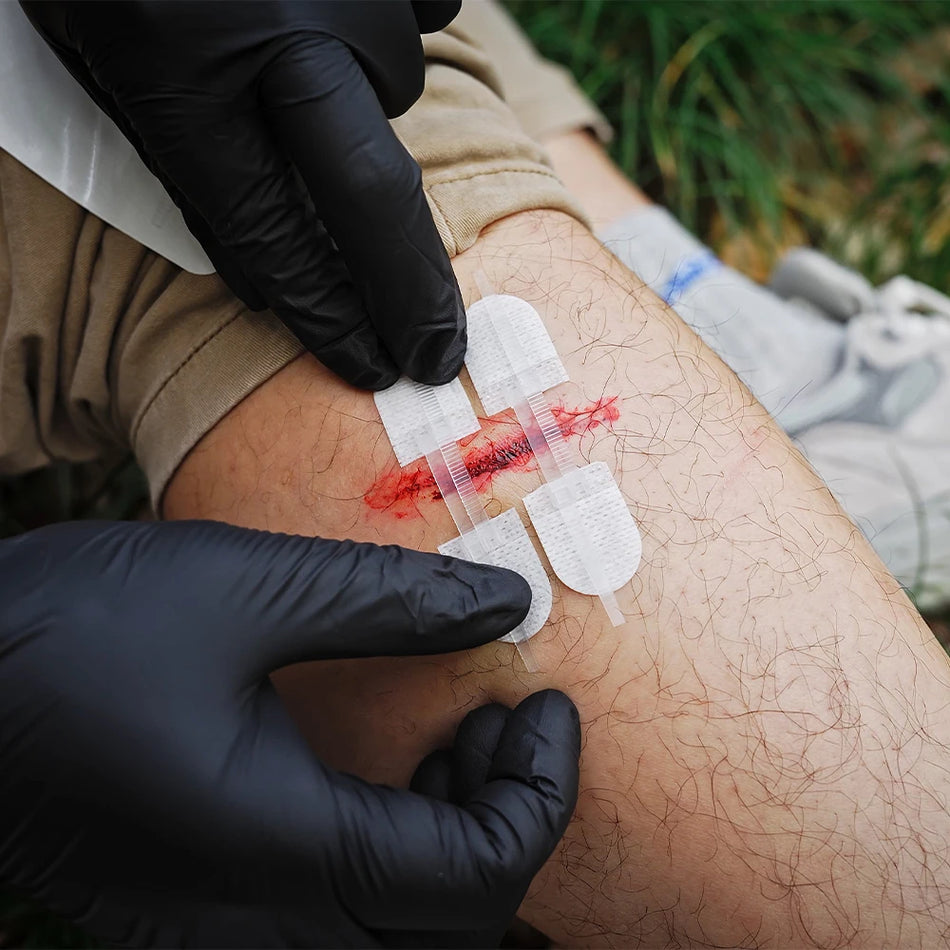 Rhino Rescue Zip Stitch Wound Closure Strips 6pcs Bandages