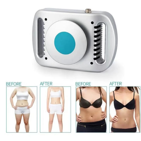 Cryolipolysis Machine &ndash; Effective Fat Freezing For Body Slimming