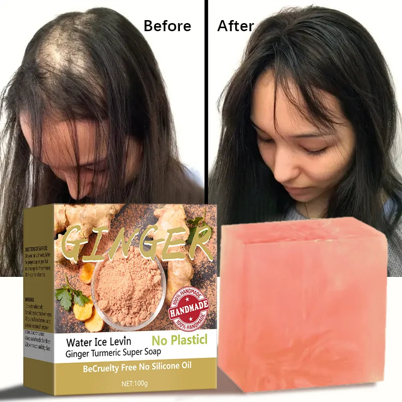 Ginger Turmeric Super Soap &ndash; Antimicrobial Hair Treatment