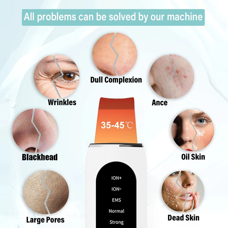 Ultrasonic Skin Scrubber For Deep Facial Cleansing, Blackhead And Pore Cleaner