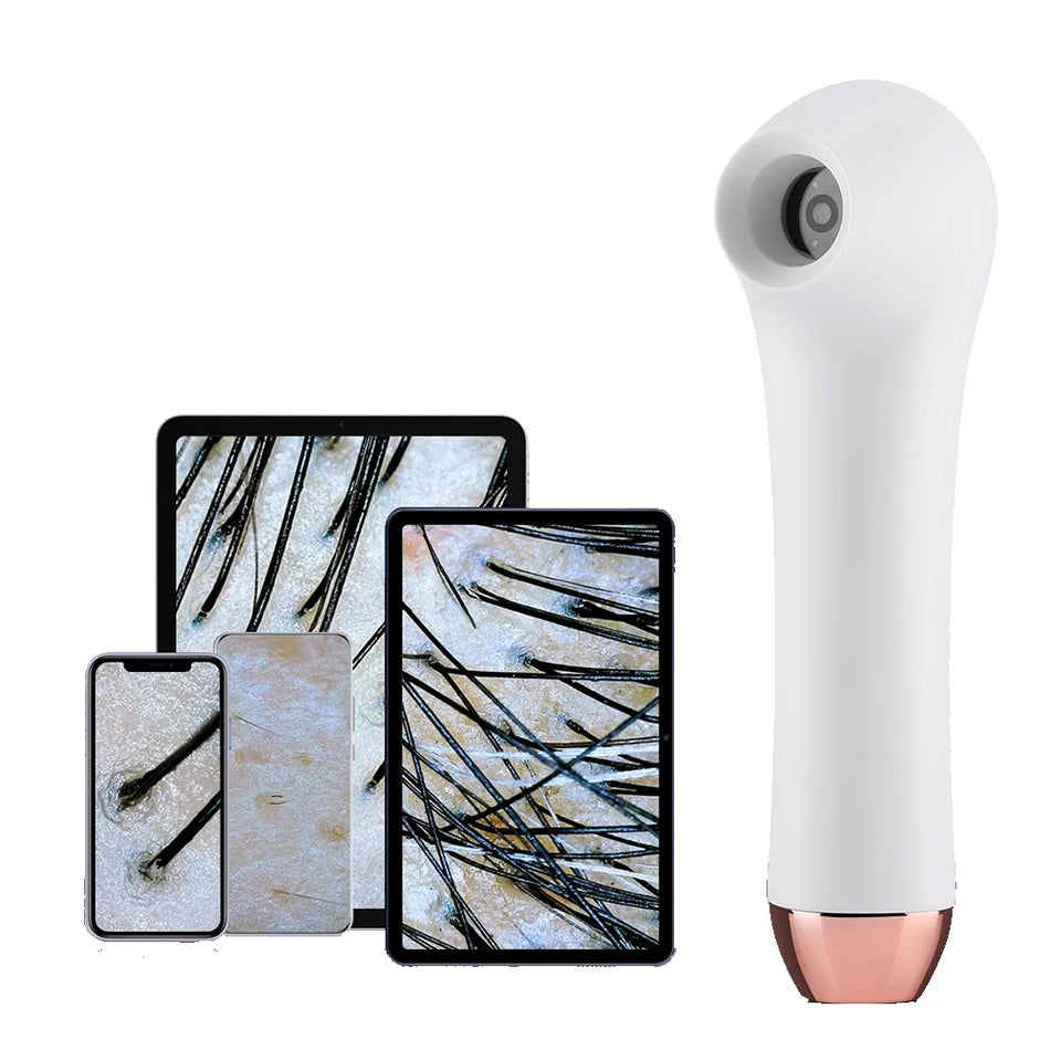 Skin Analyzer Dermatoscope &ndash; Ultra Clear Imaging Tech