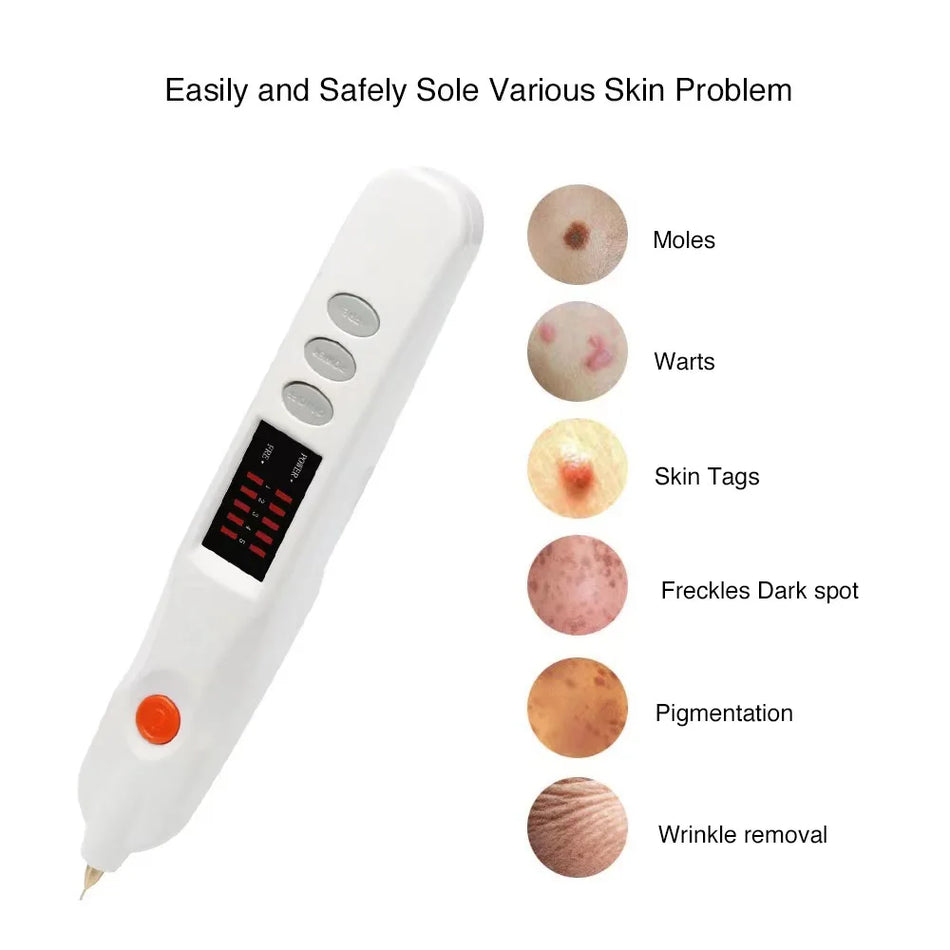 Tragbarer elektrischer Plasma-Stift für dunkle Flecken, Pigmente, Muttermale, Tattoos und Warzen