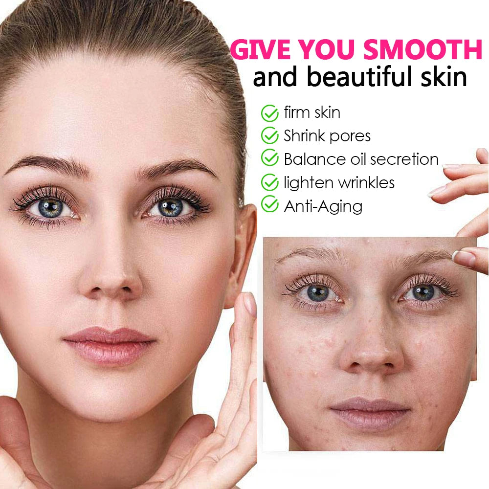 LED Red Light Photon Therapy Face Mask &ndash; Skin Rejuvenation