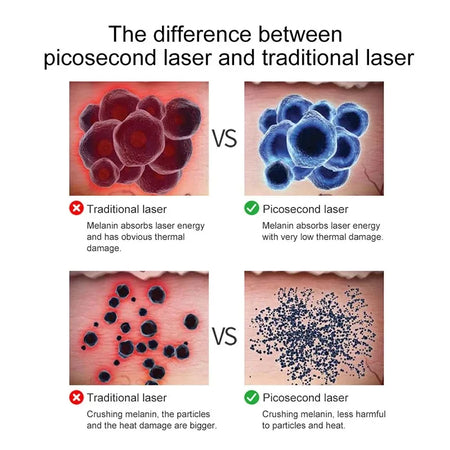 9 Level Laser Picosecond Pen &ndash; All In One Skin Rejuvenation