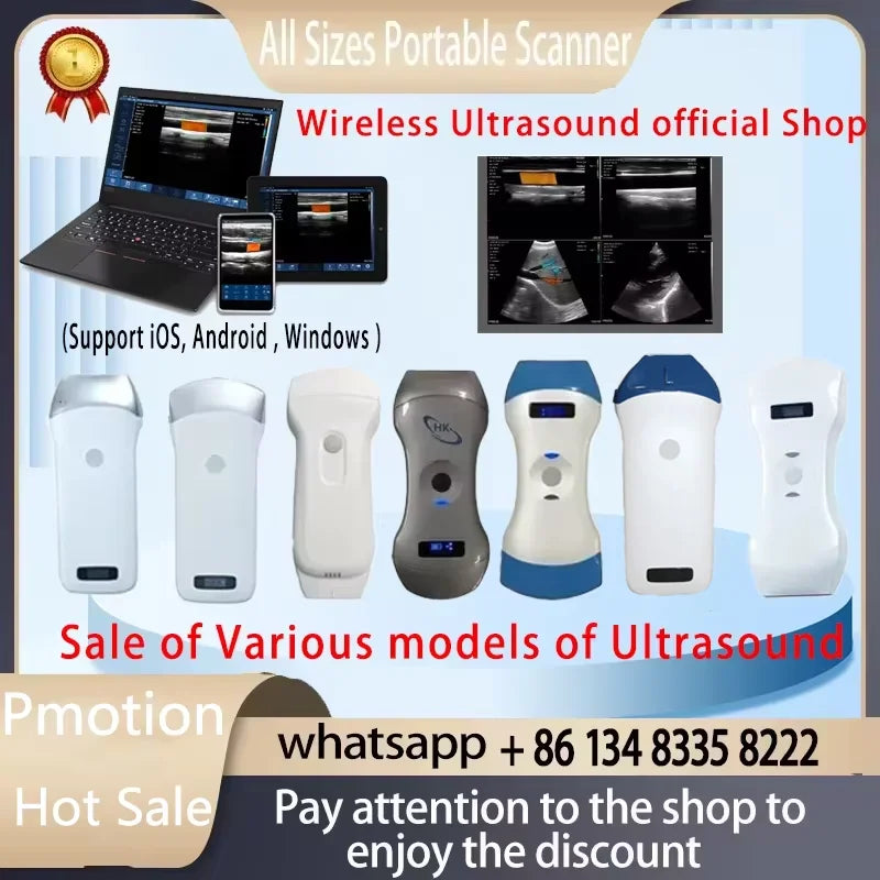 Sonostar Przenośny Bezprzewodowy Skanner Ultrasonograficzny Z OEM WiFi