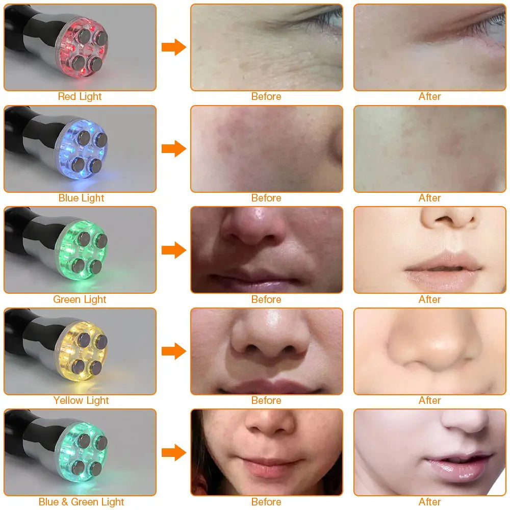 MONAI Face Massager &ndash; LED Photon Therapy For Firming