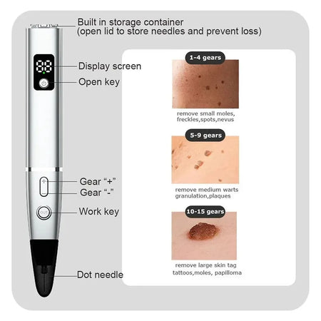Laser Plasma Pen &ndash; All-In-One Skin Tag Wart Remover