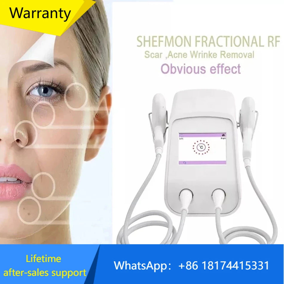 Novoxel Tixel 2 Terminis Frakcinis Mezotix Dviejų Randų Šalinimas