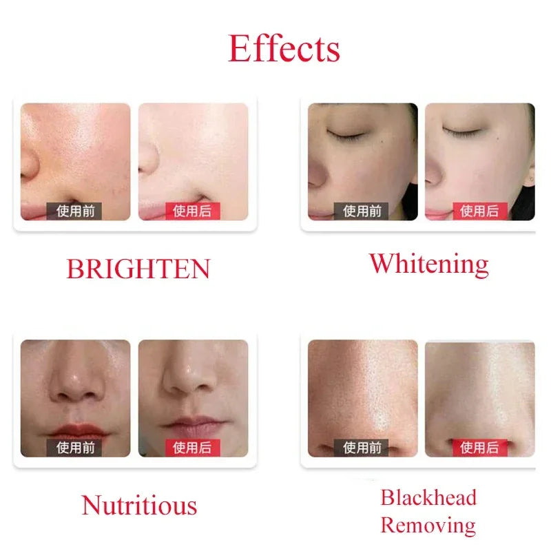 Professional Dermabrasion Serum Aqua 50ml &ndash; Deep Cleansing