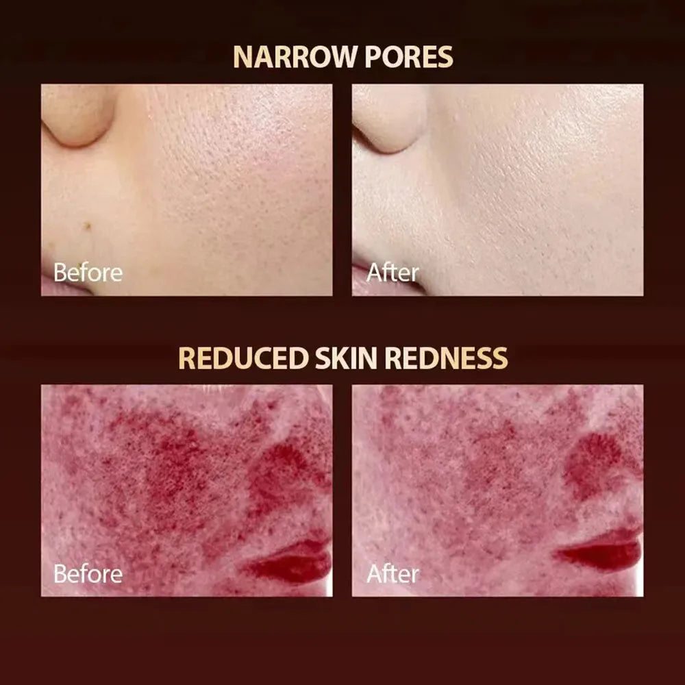 Dubniy LED Facial Mask &ndash; 7 Colors Photon Therapy for Skin Rejuvenation