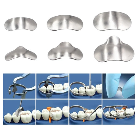 Dental Sectional Matrix System Ring Springclip &ndash; Quality