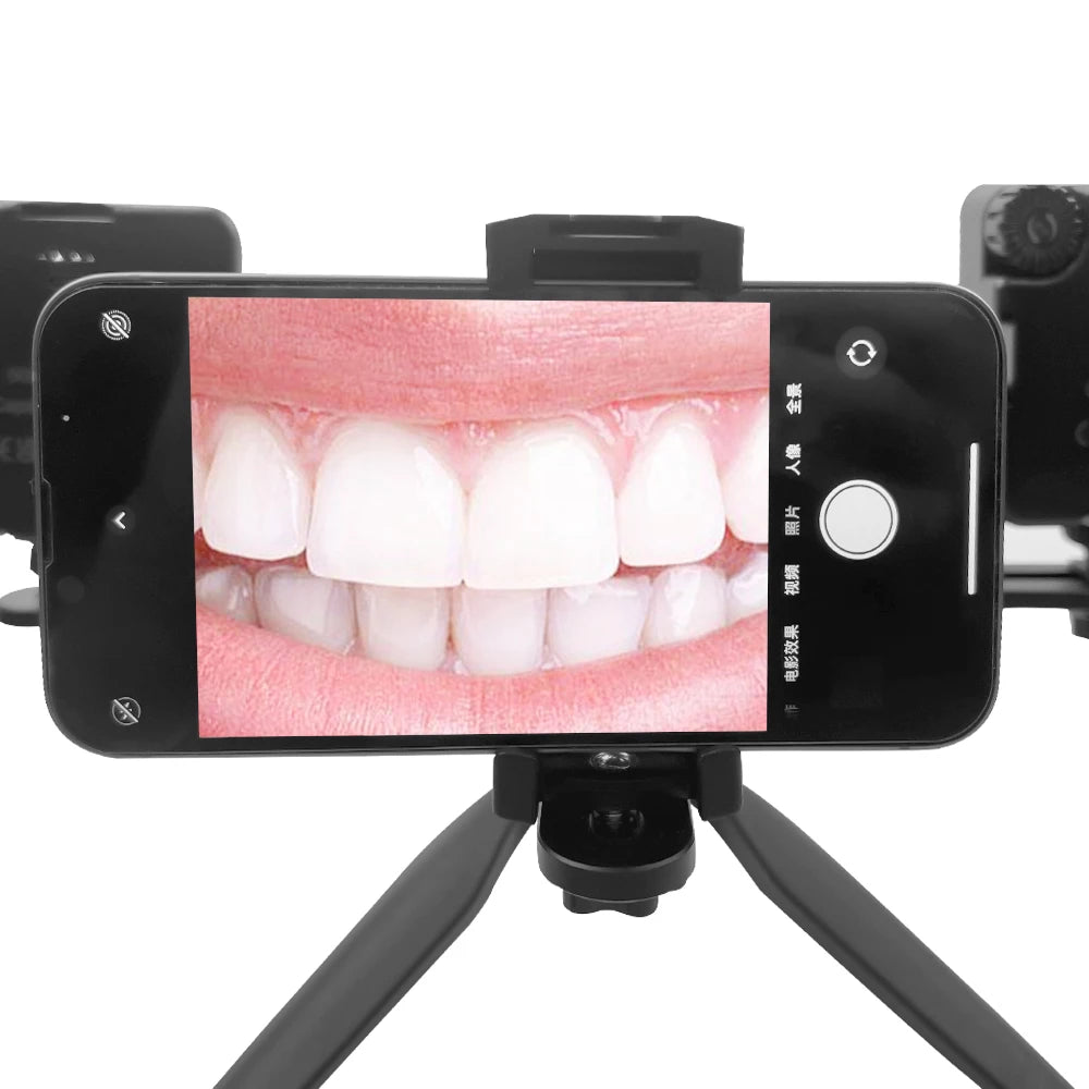 Intraoral Photography Light &ndash; LED Dental Photography Light