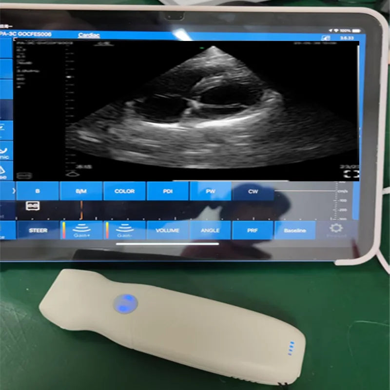 Kolorowa bezprzewodowa sonda dopplerowska serca tryb CW etui iOS