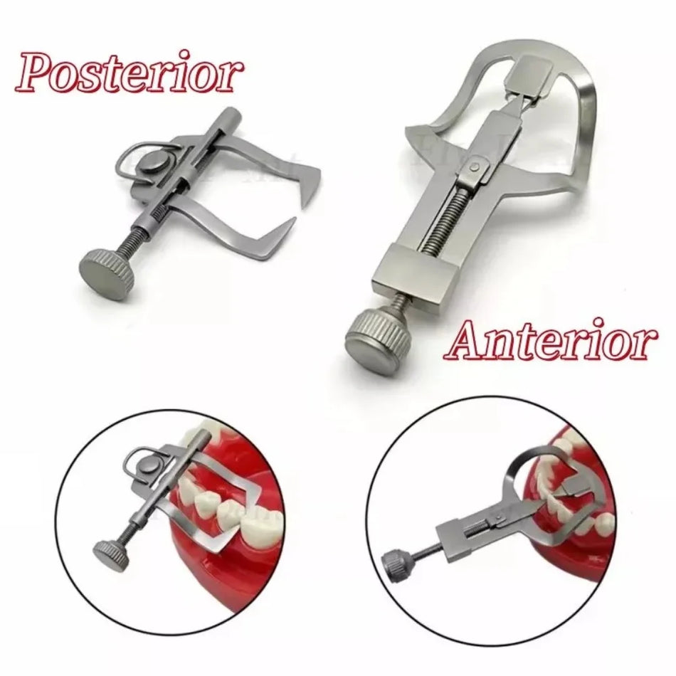 Dental Tooth Separator Wedges &ndash; Superior Precision for Orthodontic Procedures